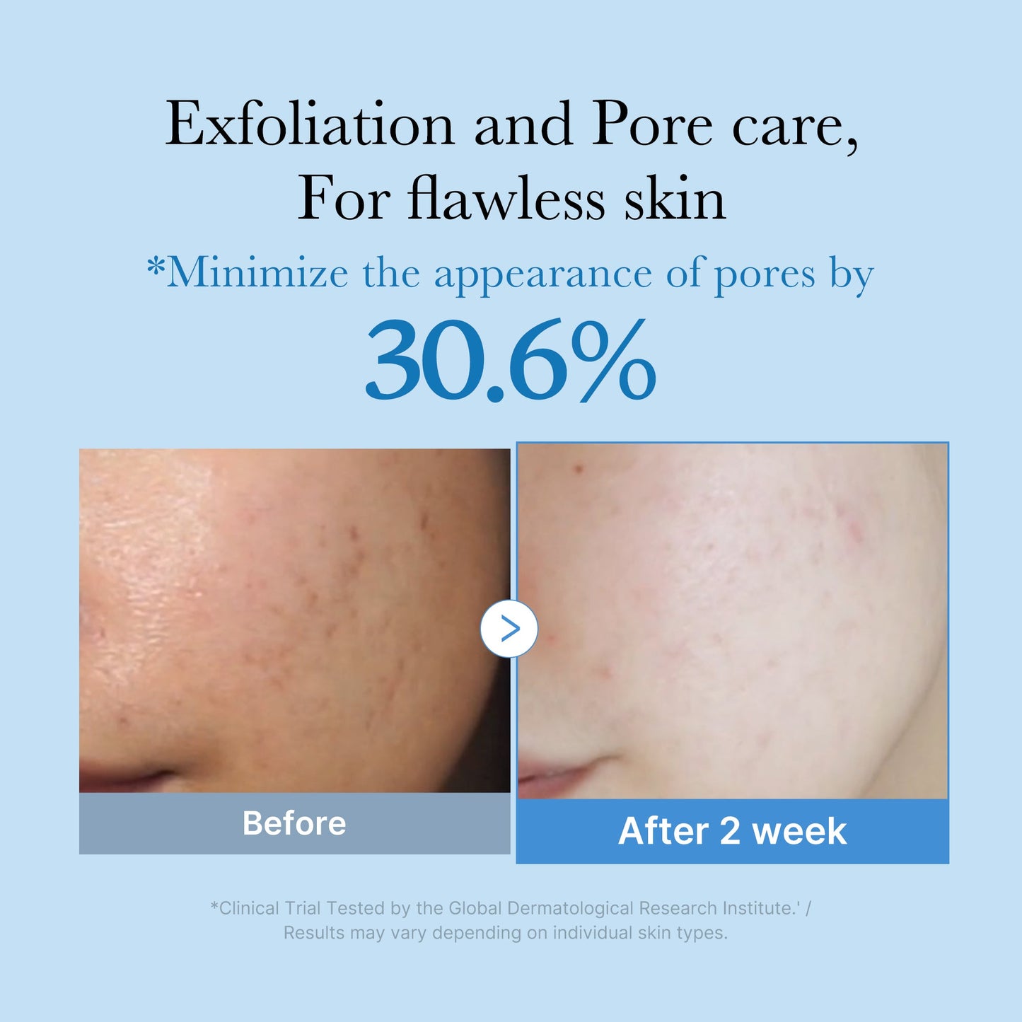 zero-pore-toner-t1 01_d6480b4e-3c08-4954-994a-ed5212c1839c.jpg