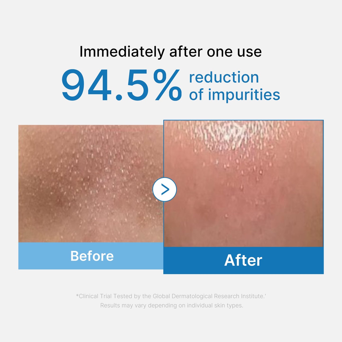 zero-pore-blackhead-deep-cleansing-oil-w2 01_eed557ec-5857-46a2-8b17-dbd67c692dcb.jpg