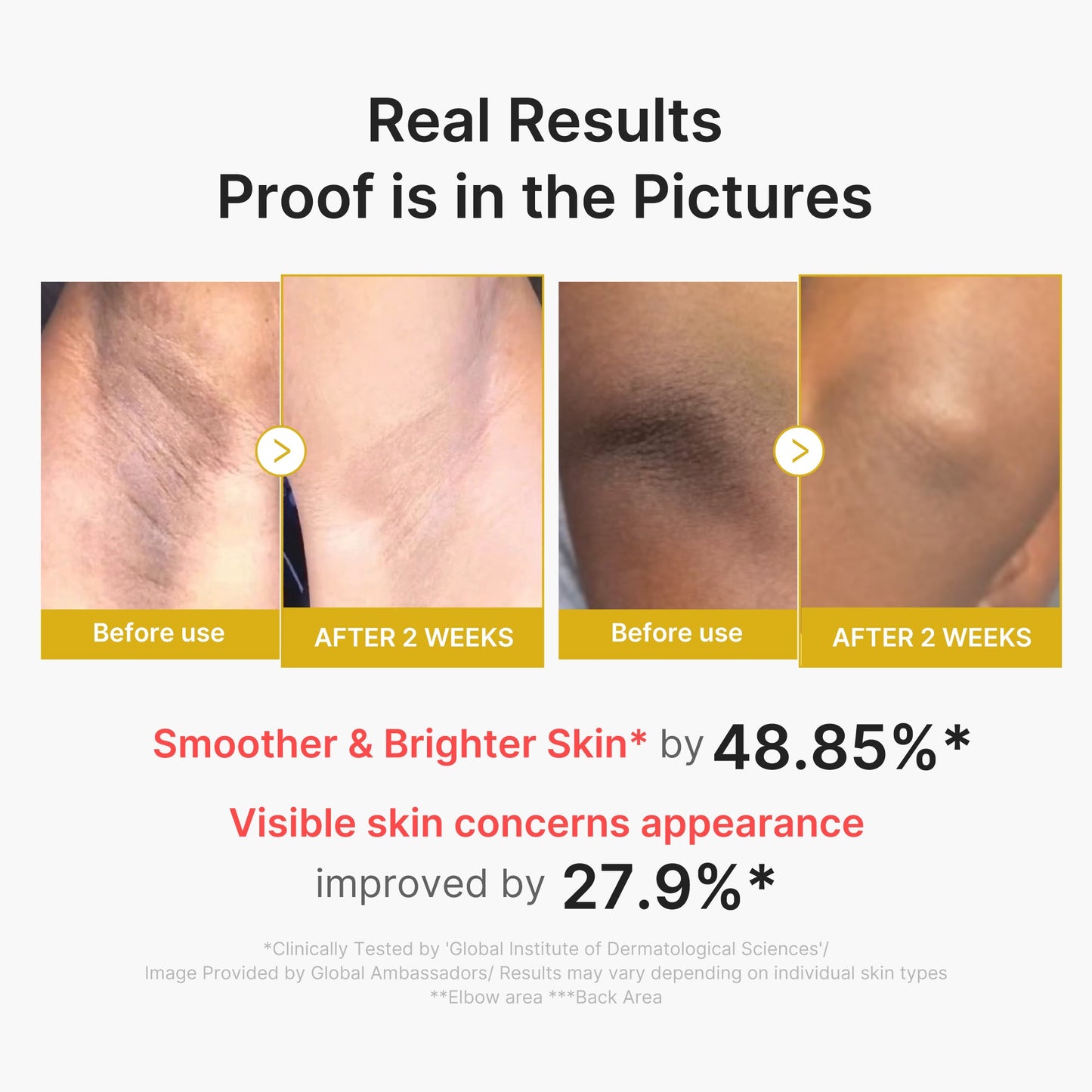 kojic-acid-turmeric-body-peel-shot-r1 02_72880cfc-382b-440b-8152-7e3dce87da2a.jpg
