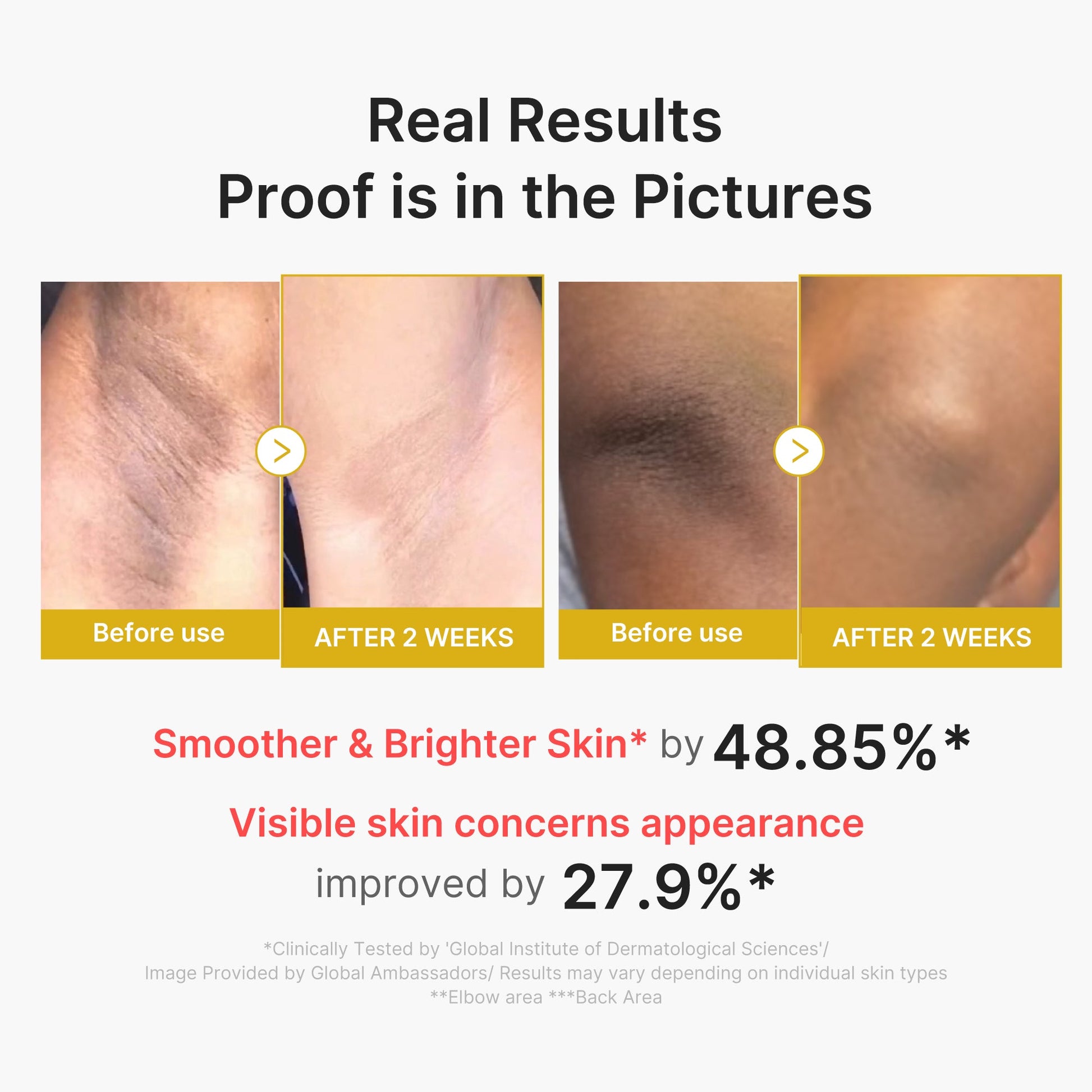 kojic-acid-turmeric-body-peel-shot-r1 02_72880cfc-382b-440b-8152-7e3dce87da2a.jpg