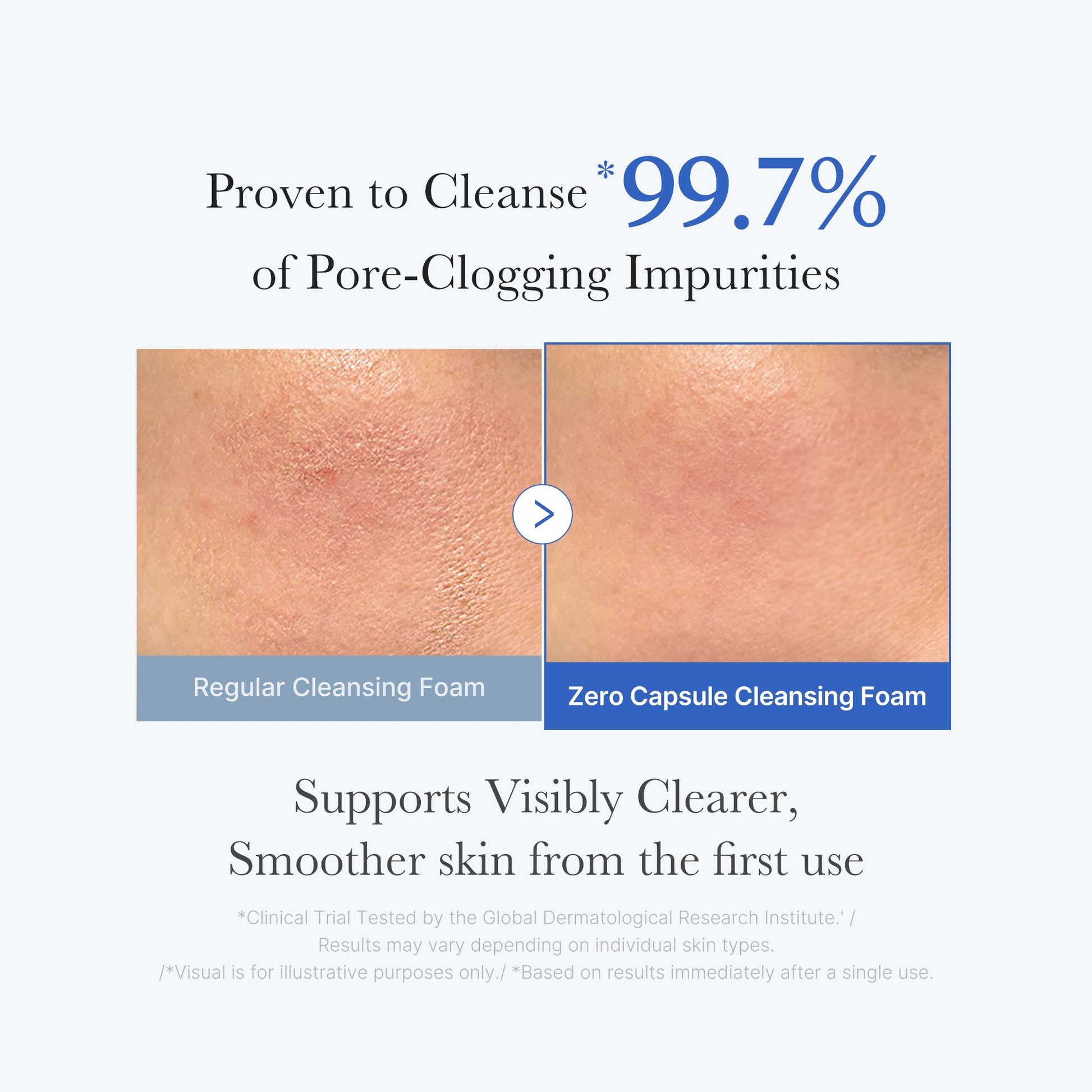 zero-pore-capsule-cleansing-foam-f1 02_c1fb9dfb-86c5-4038-8ff8-490d1006276c.jpg