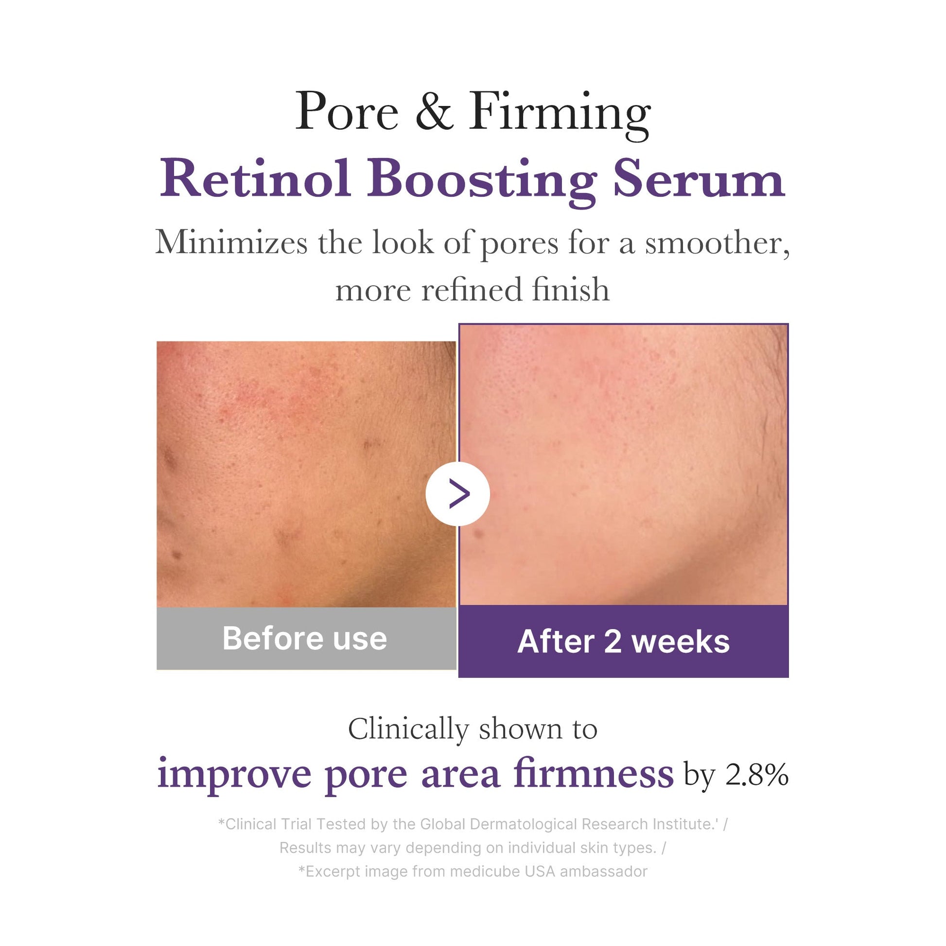 retinol-nmn-boosting-serum-v8 03_3510e7a5-5633-4a18-81ea-1389593bd517.jpg