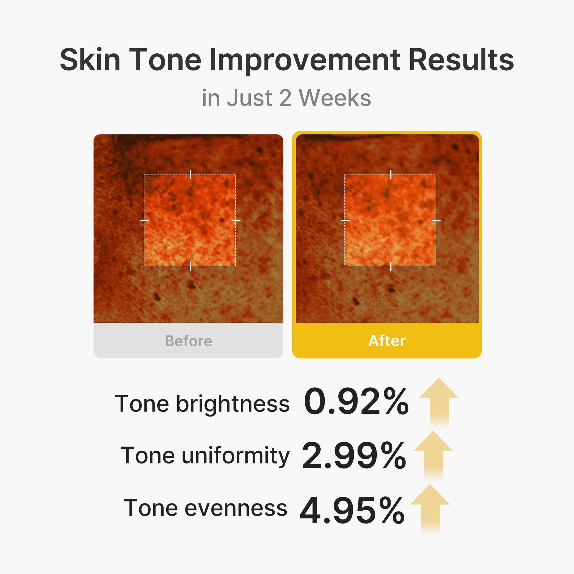 kojic-acid-turmeric-vita-capsule-cream-y4 03_2b626701-fc6c-4702-9e96-a2157a4f7f9d.jpg