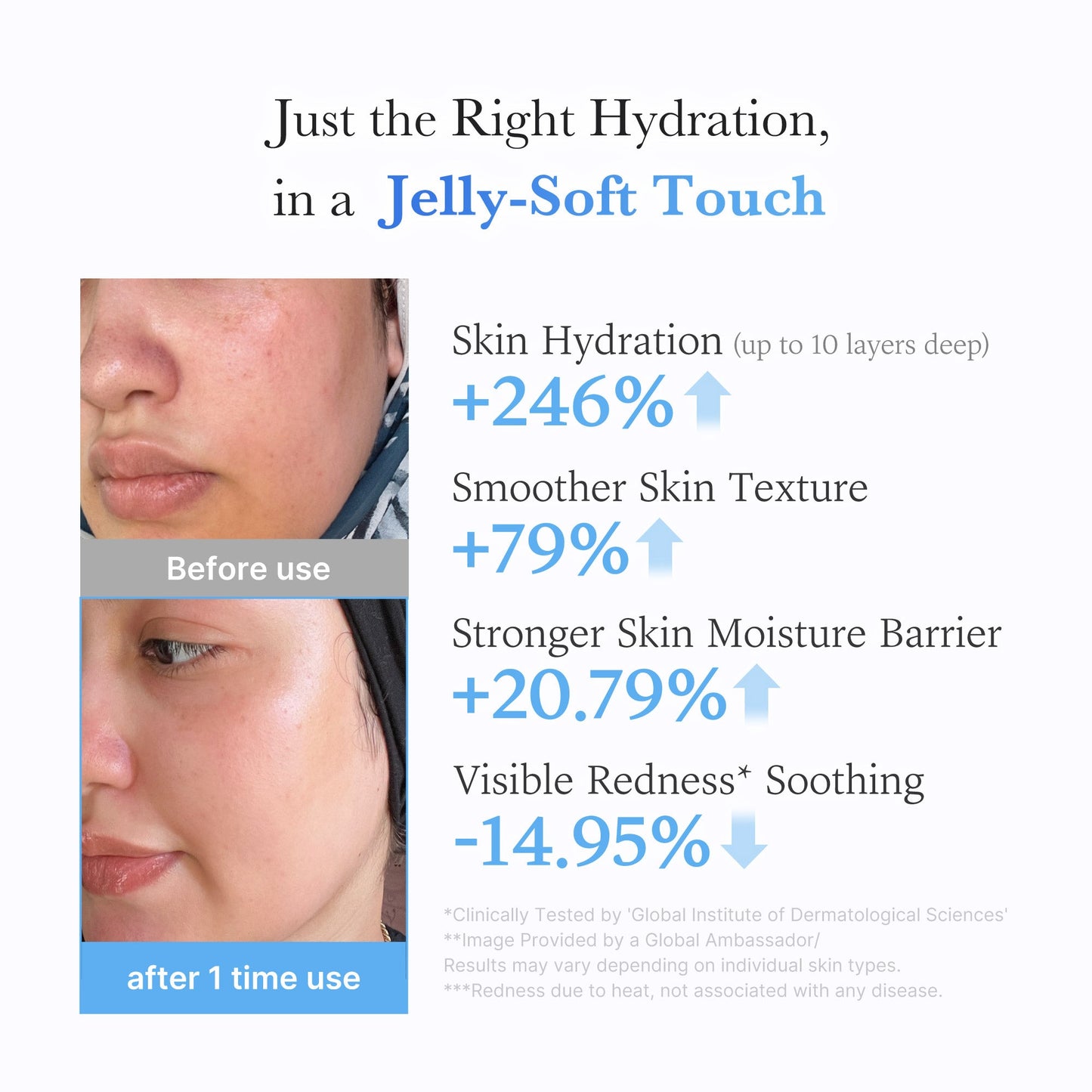 hyaluronic-ceramide-moisturizing-jelly-cream-v1 03_c39d66cc-0839-4e48-ab4a-d32143d06b1c.jpg