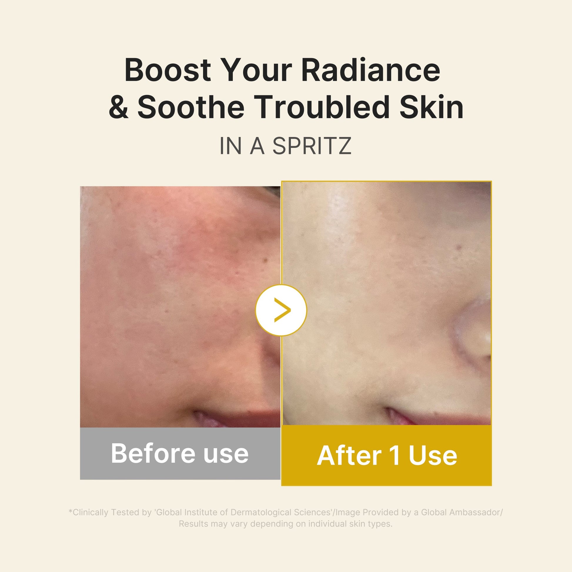 kojic-acid-turmeric-vitamin-gold-jelly-mist-serum-v4 03_dc9cd19e-4e57-49d3-9b66-c7762e8a63f1.jpg