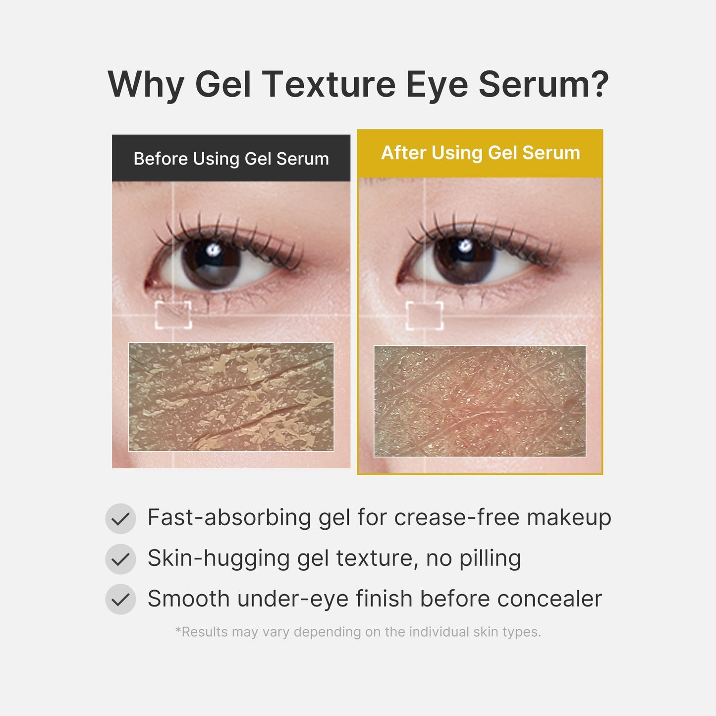 kojic-acid-tumeric-eye-gel-serum-c1 04_0487ef36-49f4-4294-8049-bb55118b05fe.jpg