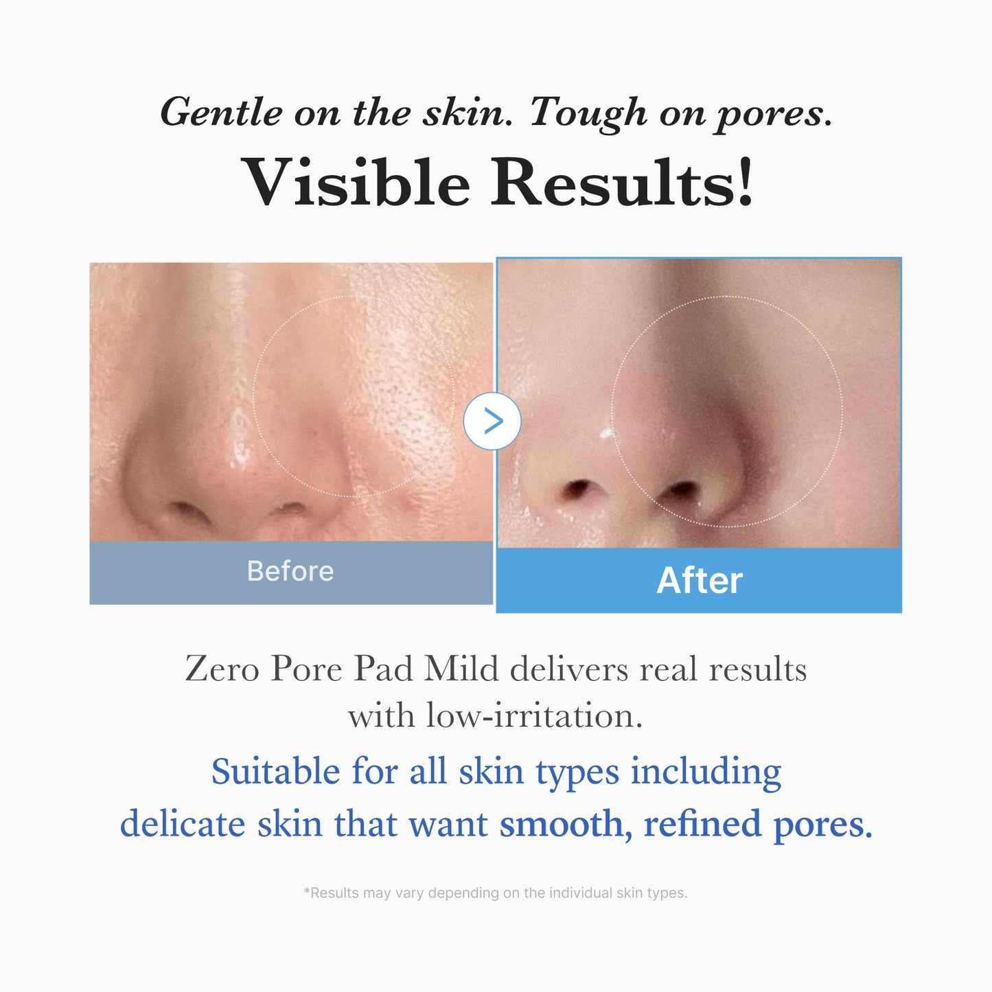 zero-pore-madecassoside-pads-mild-r9 04_6357f9f9-483b-4891-82c6-a58d336e62c8.jpg