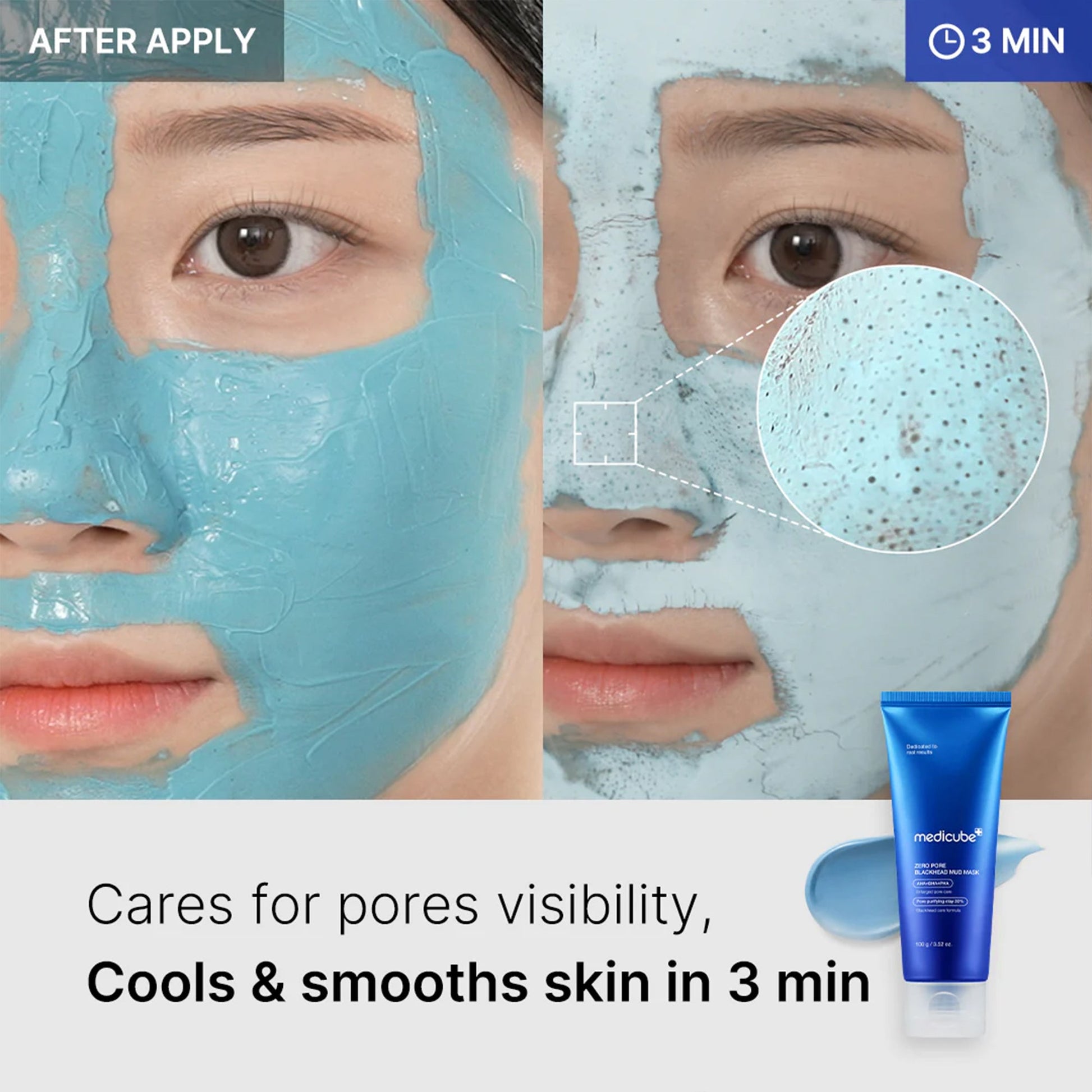 zero-pore-blackhead-mud-mask-f7 04_867c0459-a94e-40d3-bd9a-70400edabe8d.jpg