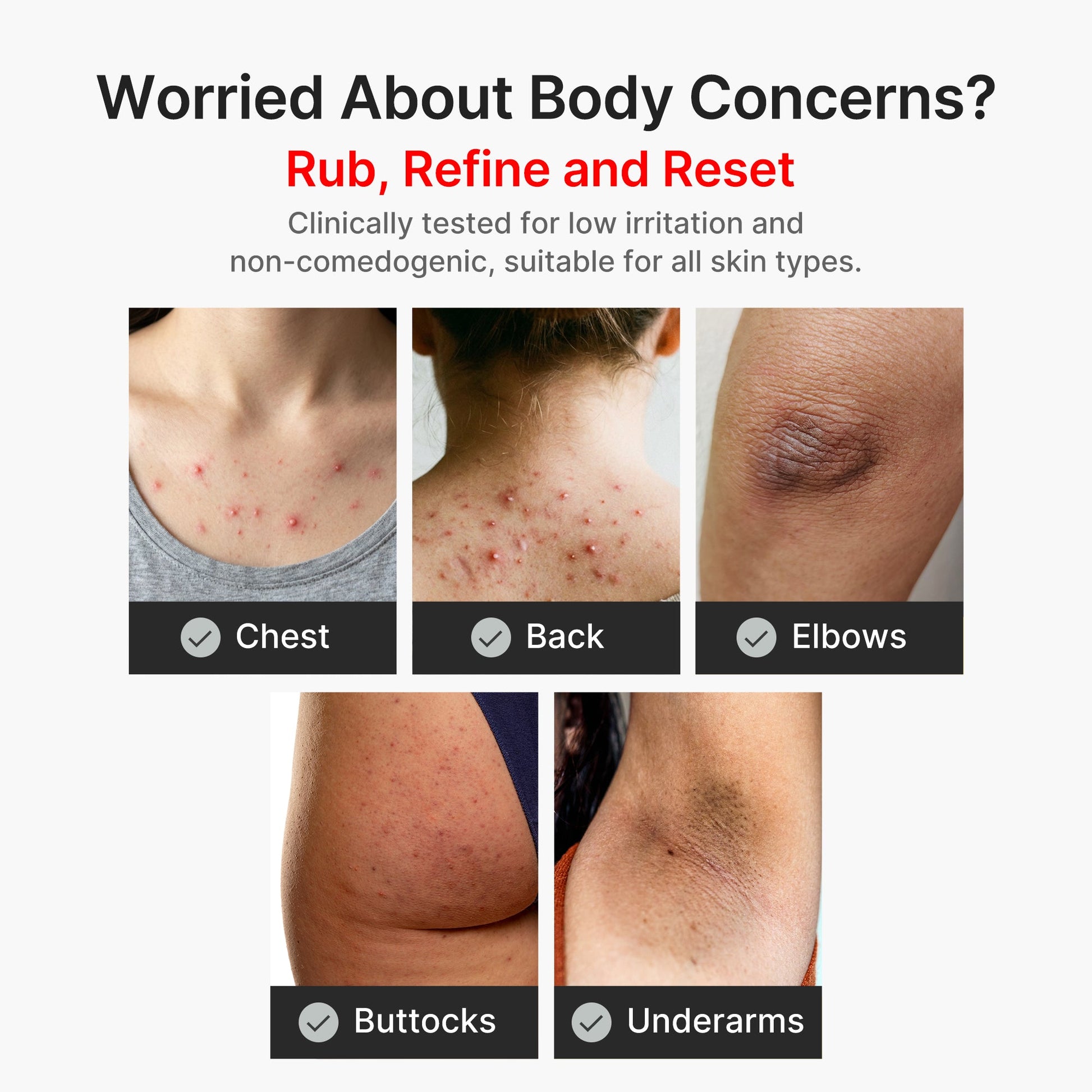 kojic-acid-turmeric-body-peel-shot-r1 04_8a7237f2-3ebf-401e-bd85-54841aeb3efc.jpg