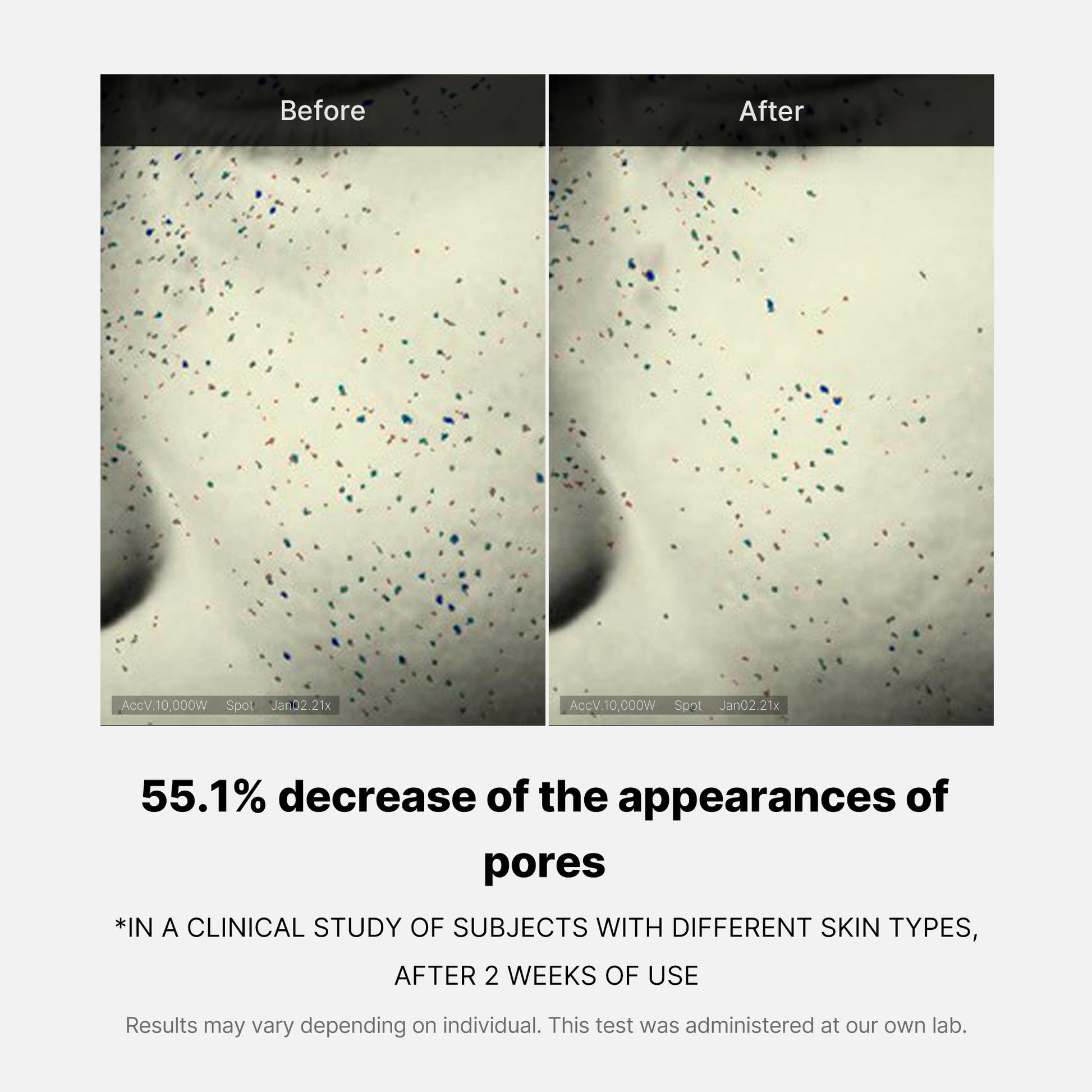 pore-care-duo-a4 05_12ddab8a-64be-4612-8ee1-27e5ec701921.jpg
