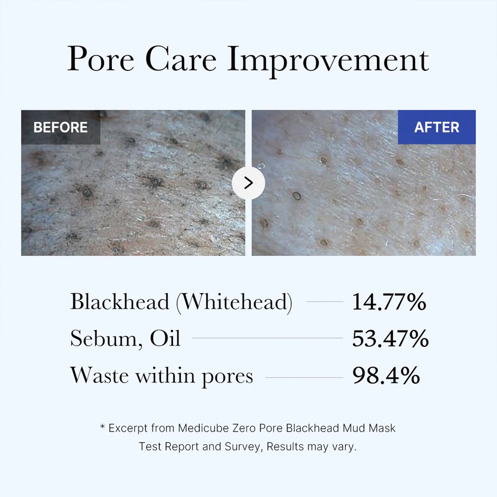 zero-pore-blackhead-mud-mask-f7 05_9362a158-c2b3-4525-acc0-631a2cfdea47.jpg
