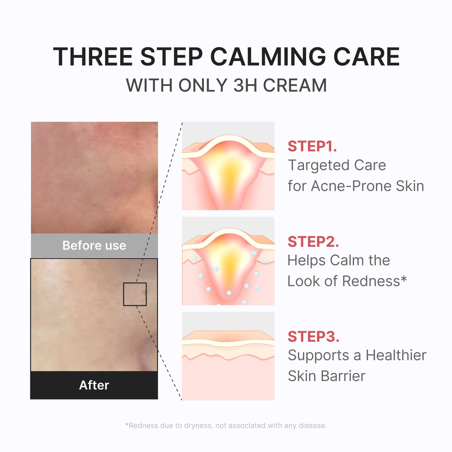 3h-daily-relief-cream-f4 3H_04.jpg
