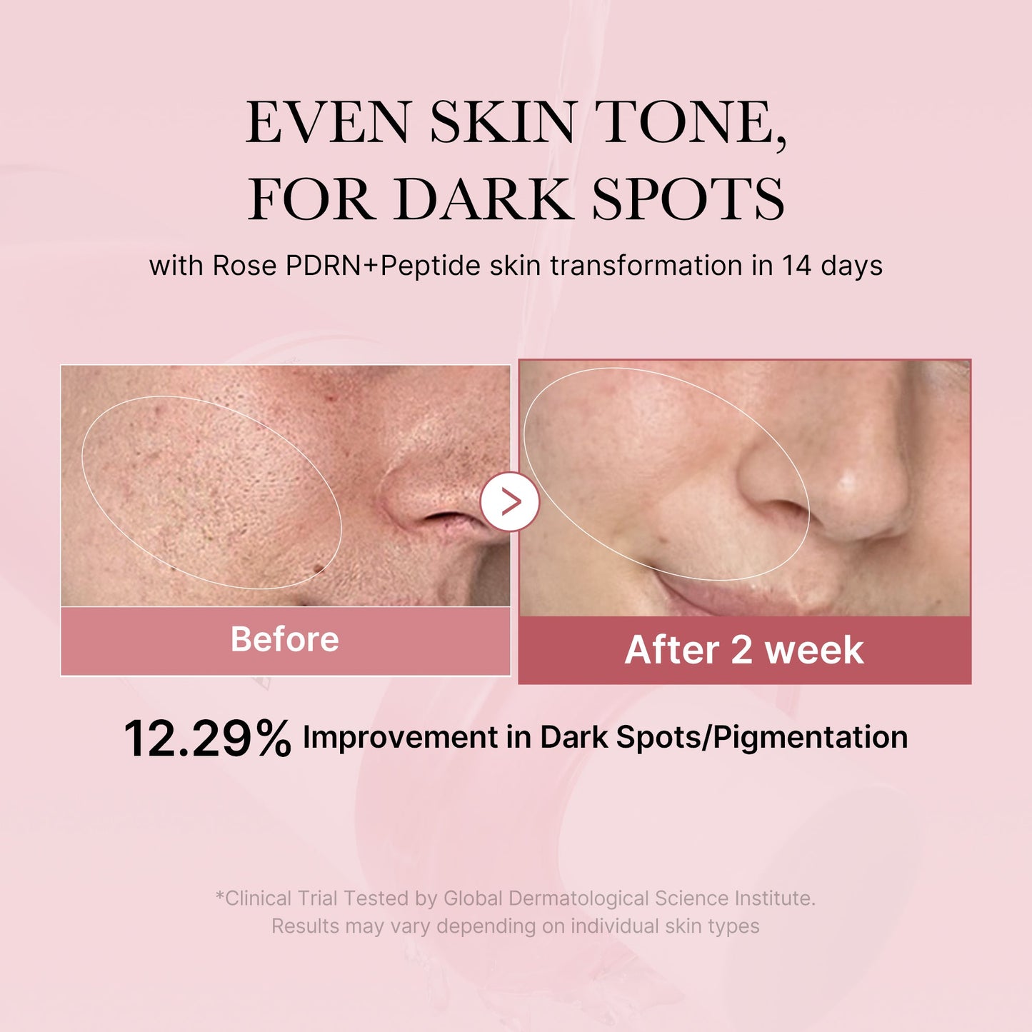 pdrn-pink-peptide-toner-l5 PDRN_01_308c518e-5ac6-4e54-99bd-eabc8796739b.jpg