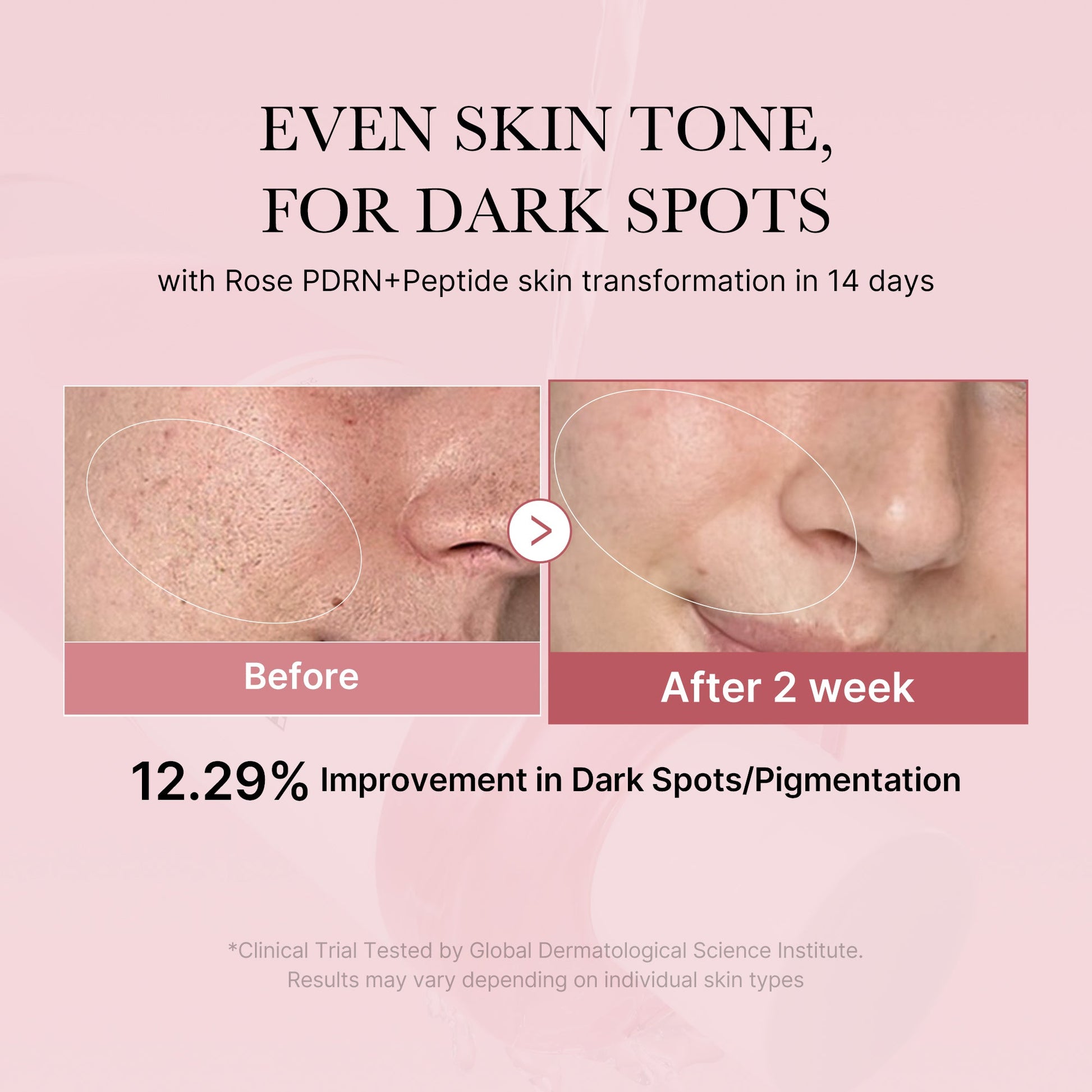pdrn-pink-peptide-toner-l5 PDRN_01_308c518e-5ac6-4e54-99bd-eabc8796739b.jpg