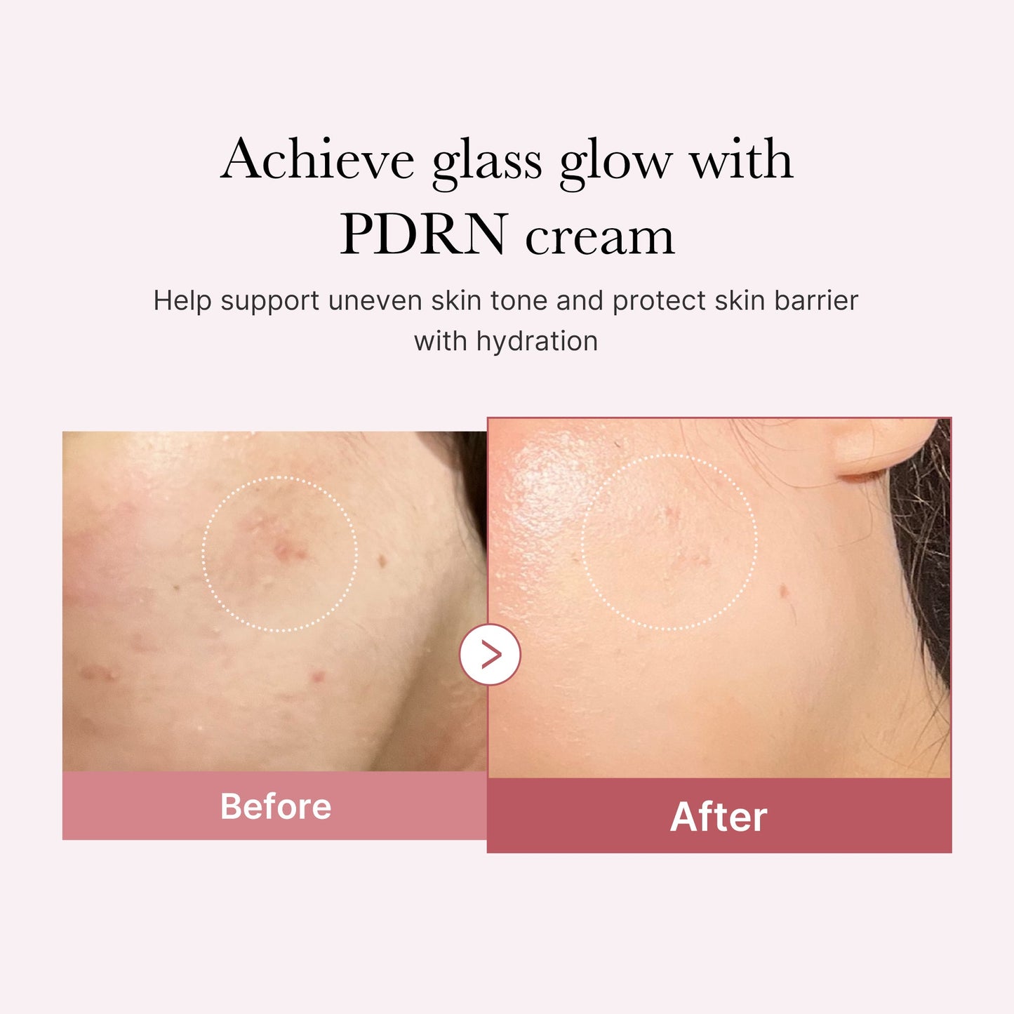 pdrn-pink-peptide-cream-p1 PDRN_02_d7805bfe-cf43-446a-b71b-a276683f136b.jpg