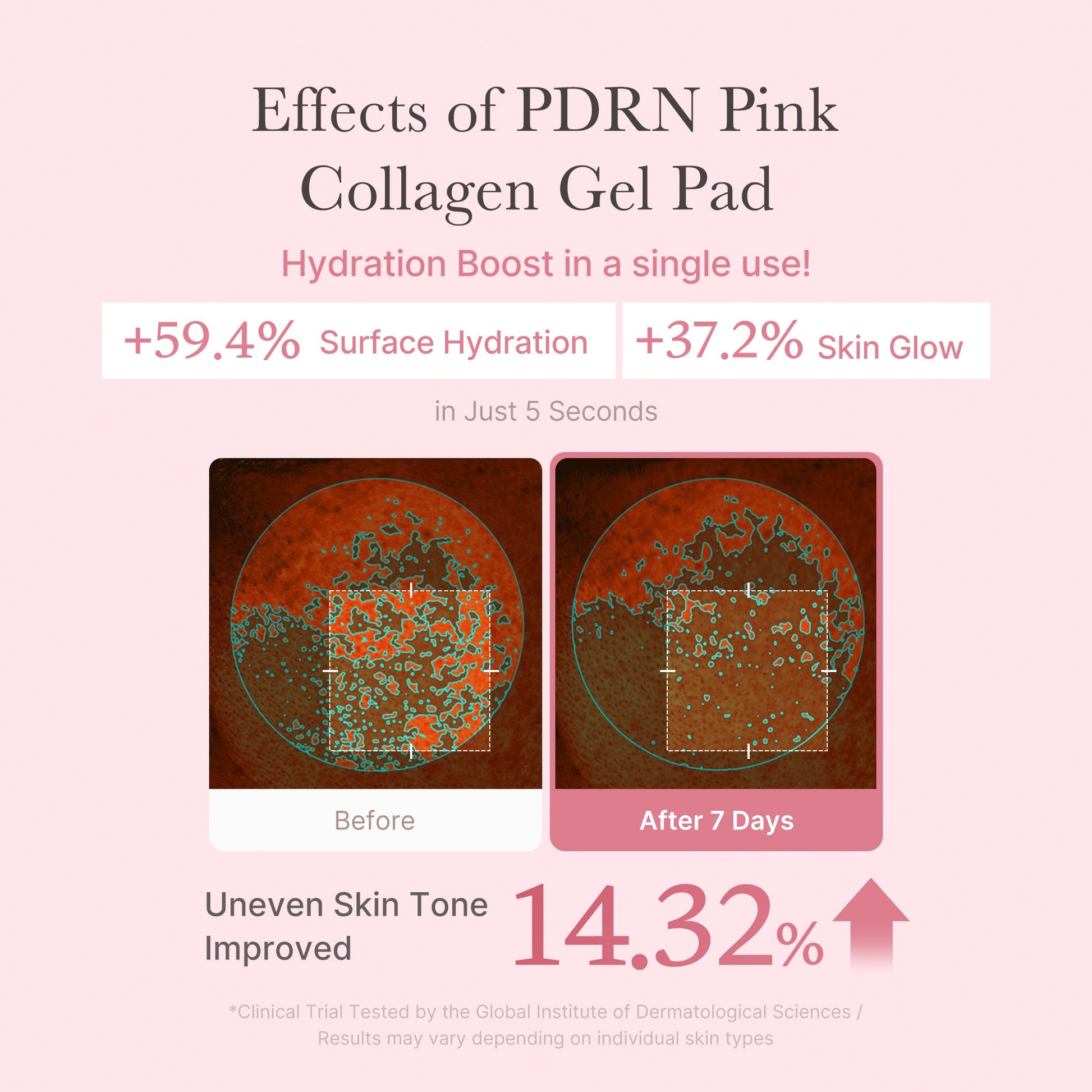 pdrn-pink-collagen-gel-toner-pad-k6 PDRN_04_f9a16a56-8d9e-4c47-a635-ed34ec3ed571.jpg