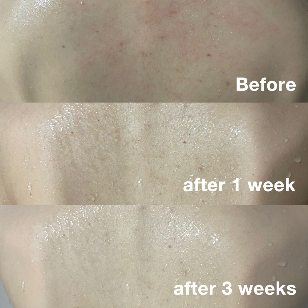 red-line-ultimate-face-and-body-care-set-i6 body_1195bc70-5acf-4559-b0cc-7d4509ae6629.jpg