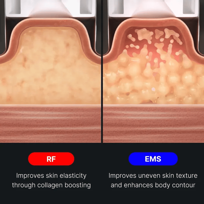 age-r-contour-body-shot-l5 img.webp